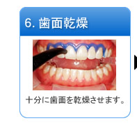 6.歯面乾燥